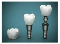 Digital Dental Implants Sydney | To make your Dream Smile - Citi