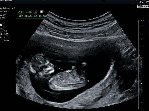 Connect with Your Baby Instantly with 24/7 Reassurance Scan - Altele