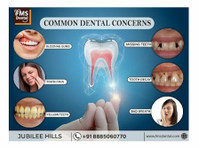 Dental Implant Clinic Hollywood Smile Designing - Kauneus/Muoti