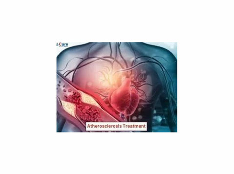 Atherosclerosis Treatment – Expert Care with Edhacare - دیگر