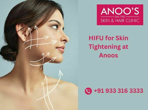 Advanced Hifu Treatment for Skin Tightening at Anoos - Làm đẹp/ Thời trang