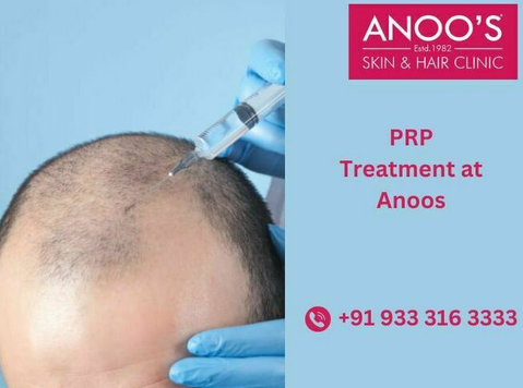 Advanced Prp Treatment at Anoos - Szépség/Divat
