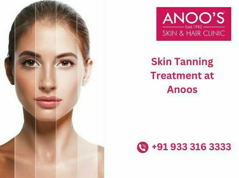 Advanced Tan Removal Treatment at Anoos - Moda/Beleza