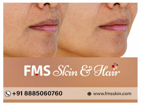 Best Open Pores treatment In Kondapur Hyderabad - Skaistumkopšana/mode