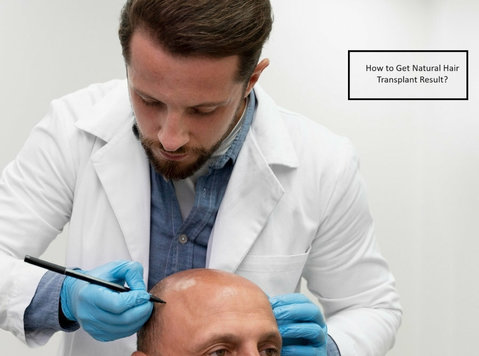 How to Get Natural Hair Transplant Result? - Beauty/Fashion