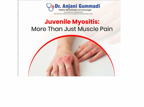 Juvenile Arthritis in Kids:Pediatric Expert in Hyderabad - Beauty/Fashion