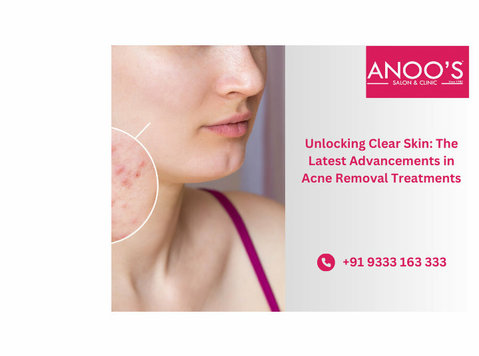 Reclaim Clear Skin with Anoos Acne Removal Treatment - زیبایی‌ / مد