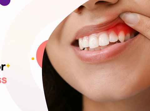 Best Dental Clinic in Kolhapur | Dentist in Kolhapur - Services: Other