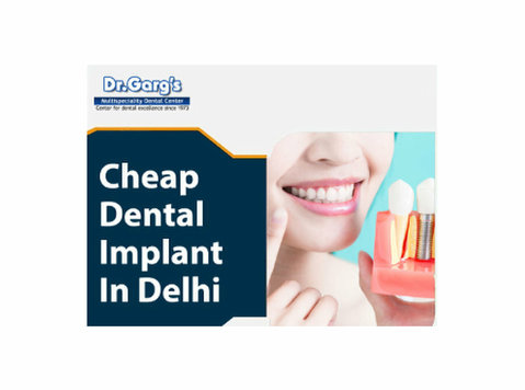 Cheap Dental Implant in Delhi - Drugo
