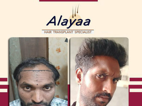 Guide to Latest Techniques, Best Hair Transplant Clinic in C - Lain-lain