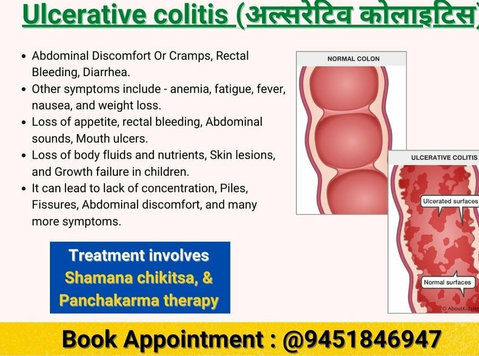 Piles doctor in Allahabad - Outros