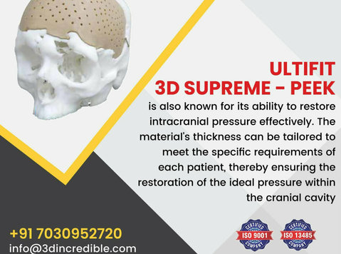 Ultifit: A Patient-specific 3d Printed Cranial Implant - Services: Other
