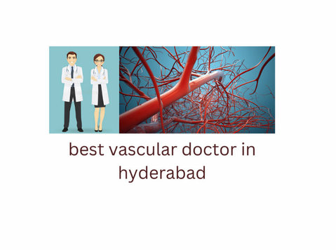 best vascular doctor in hyderabad - Annet