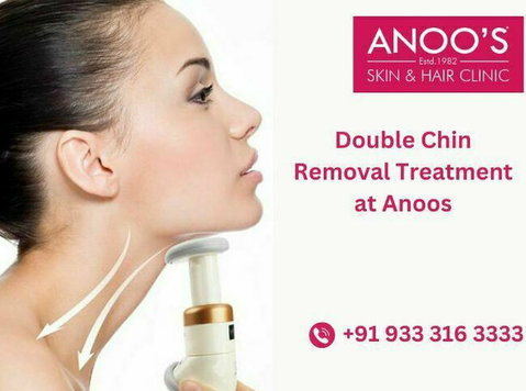 Advanced Double Chin Removal Treatment at Anoos - Moda/Beleza