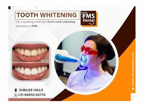 Best Dental Clinic in Jubilee Hills - Tooth Whitening - Убавина / Мода