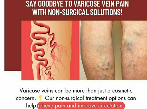 Specailist For Varicose Veins In Hydeabad - Services: Other
