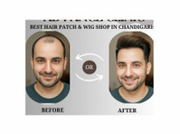 Advance Hair Clinic: Hair Extensions, Hair Patch, Toppers. - Muu