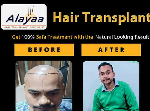 Dhi Hair Transplant Clinic in Chandigarh | Restore Your Hair - อื่นๆ
