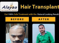 Dhi Hair Transplant Clinic in Chandigarh | Restore Your Hair - Diğer