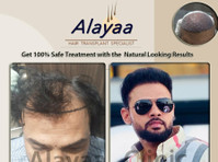 Dhi Hair Transplant Clinic in Chandigarh | Restore Your Hair - Autres