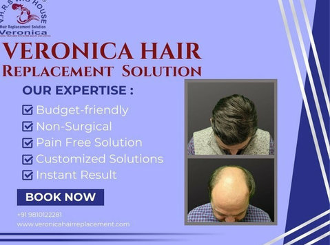 Hair Replacement - wigs & Patch Fixing in Noida - Egyéb