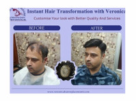 Hair Replacement - wigs & Patch Fixing in Noida - その他