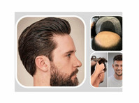 Hair Replacement - wigs & Patch Fixing in Noida - Sonstige