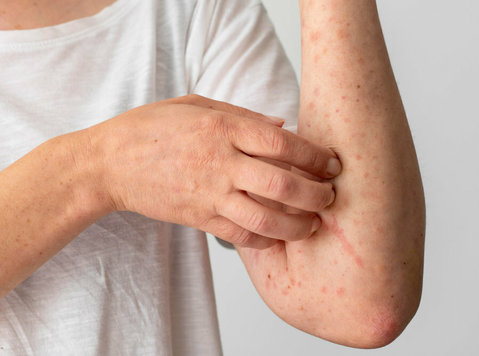 Best Quality Online Video Lectures for Dermatology Md - غیره