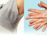 Effective Solutions for Excessive Sweating at Derma Station - 美丽与时尚