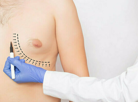 Gynecomastia Recurrence: Is It A Real Concern - Dr. Lokesh - Красота / Мода