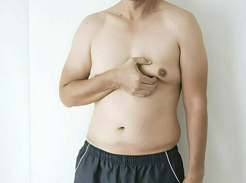 Gynecomastia Surgery in Delhi - Dr. Lokesh Handa - Beauty/Fashion