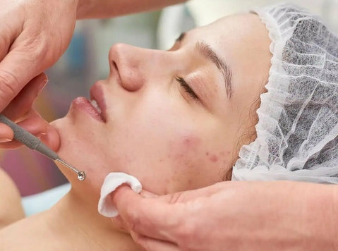 Smooth Your Skin with Targeted Acne Scar Treatments in Delhi - Убавина / Мода