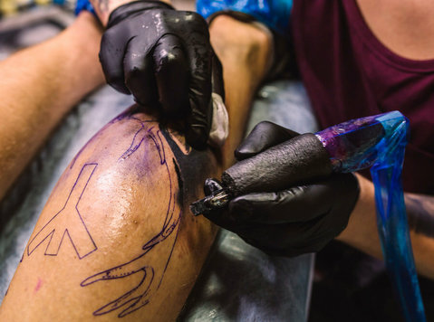 Tattoo Removal in Delhi – Safe, Effective & Scar-free - Убавина / Мода