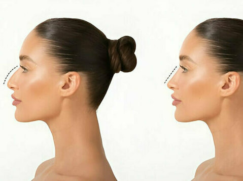 Who is the Best Rhinoplasty Surgeon in India? - Ljepota/moda