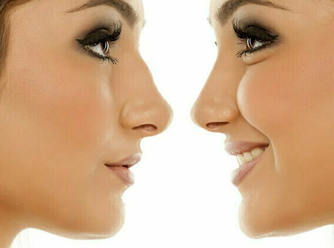 "result-specific Rhinoplasty Surgery by Dr. Lokesh Handa - Красота / Мода