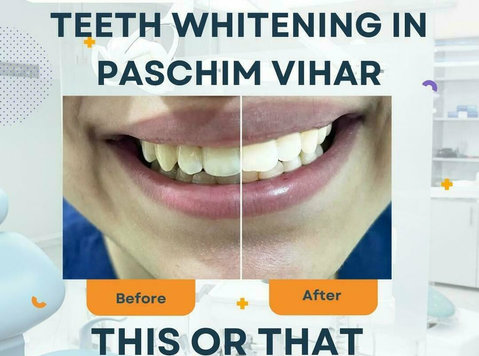 Dentist in Paschim Vihar - Whitestar Dental Clinic - Parceiros de Negócios