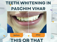 Dentist in Paschim Vihar - Whitestar Dental Clinic - Mitra Bisnis