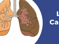 Best Lung Cancer Treatment Hospital in Delhi - மற்றவை