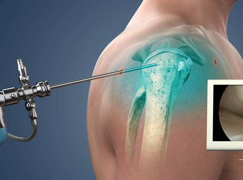 Get an appointment of Best Shoulder Surgeon in Delhi - Services: Other