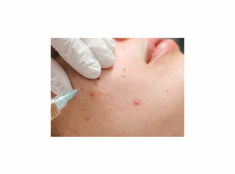 Acne Treatment in Ahmedabad, Gujarat: Dr. Krupa - Beauty/Fashion