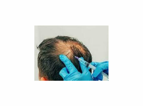 Prp Hair Treatment ​in Ahmedabad, Gujarat - Ilu/Mood
