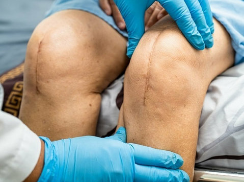Best Knee Replacement Surgeon in Ahmedabad - Друго