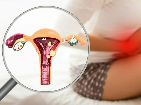 Top Rated Endometriosis Specialist in Ahmedabad - Ostatní