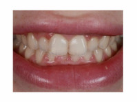 Cosmetic Dentistry In Ahmedabad - Beauty/Fashion