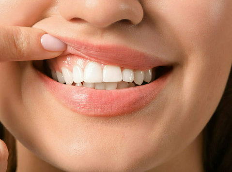 Nurturing Radiant Smiles: The Crucial Role of Teeth Cleaning - Uroda/Moda