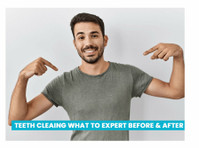 What You Should Expect During a Dental Teeth Cleaning - เสริมสวย/แฟชั่น