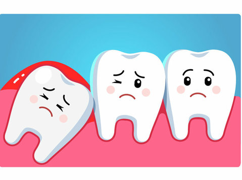Wisdom Teeth Removal Cost in Ahmedabad - Beauty/Fashion