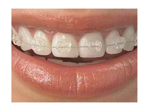 Replace Your Damaged Teeth with Dental Implant at Us Dental - 其他
