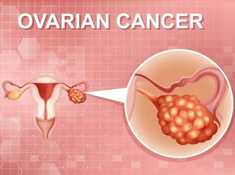 Top-rated Surgeons for Ovarian Cancer Surgery in Ahmedabad - Останато