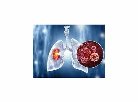 Affordable Lung Cancer Treatment in India - Citi